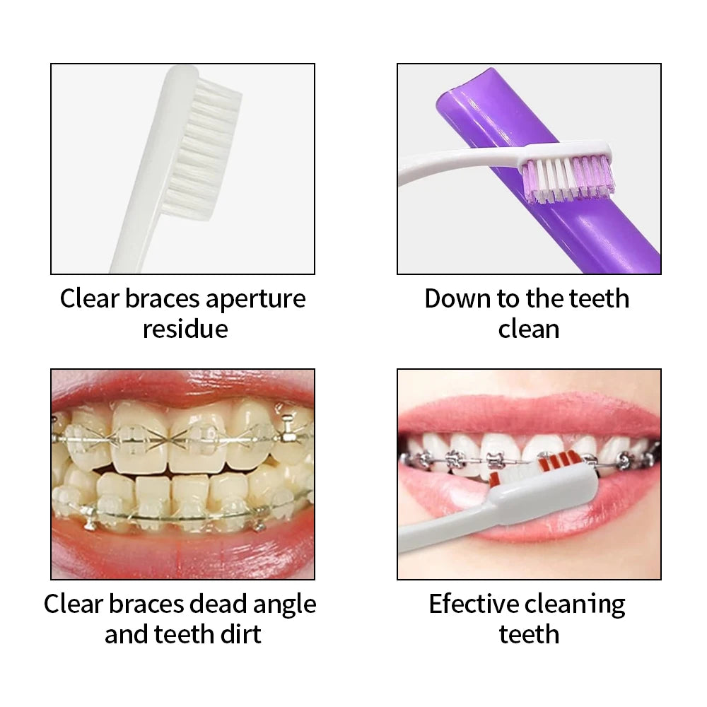 8pcs/Box Orthodontic Oral Care Kit Clean Braces Portable Travel Toothbrush Mirror Interdental Brush Supplies Floss Thread Tool